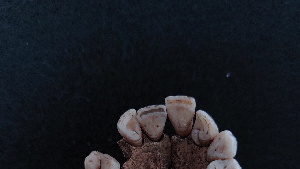 Bild zeigt ein Gebiss